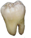 Tooth
